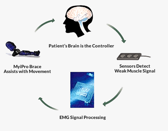 How MyoPro™ Works
